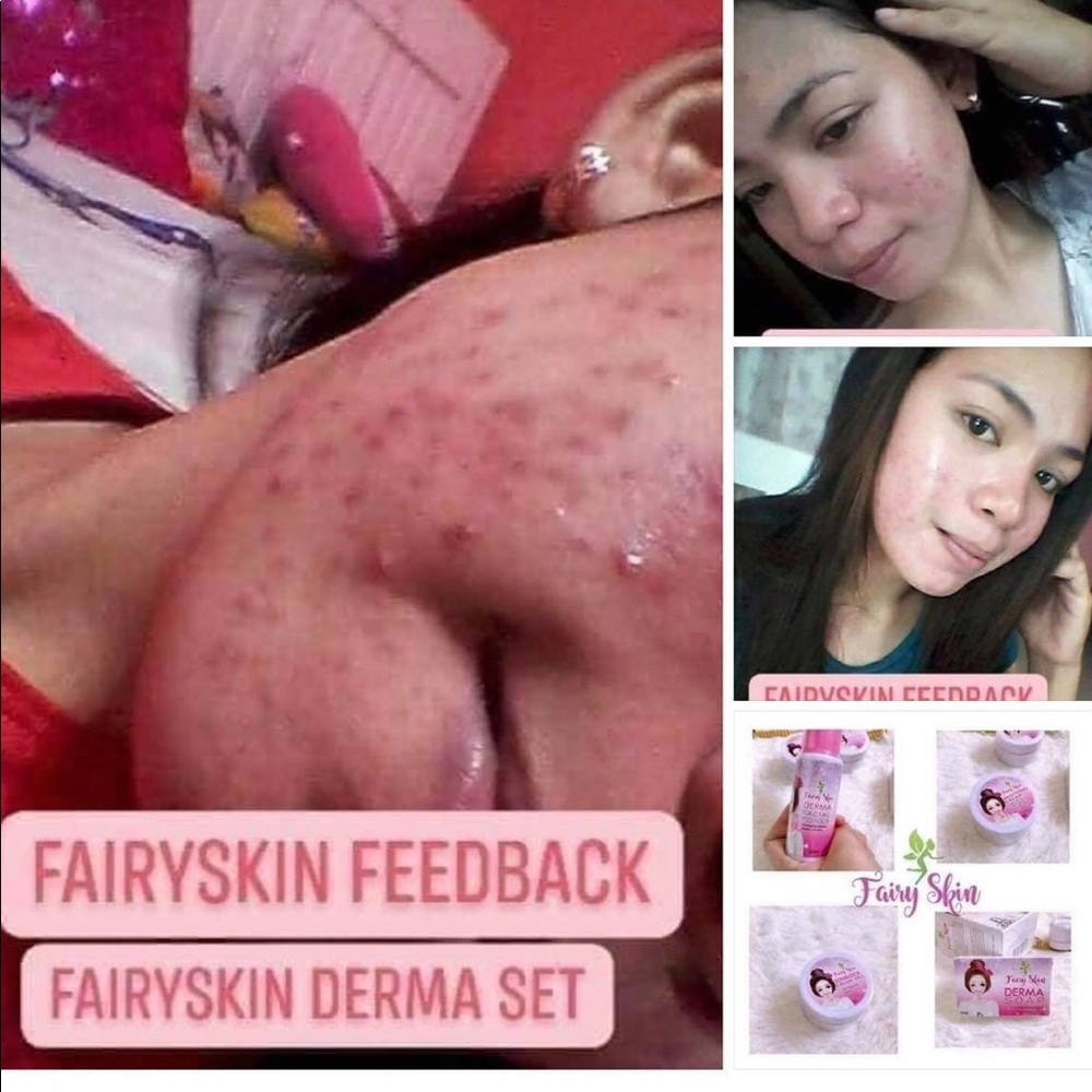 Fairy Skin Derma Facial Set Rejuvenating Whitening